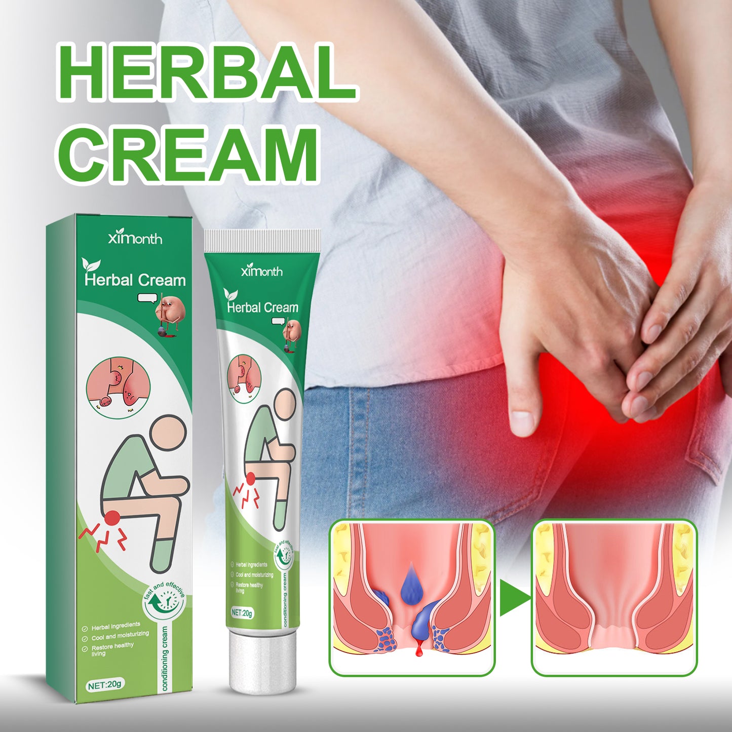 Ximonth Herbal Extract Cream for Hemorrhoids Relieves Itching Pain Discomfort Around the Anus Body Care Cream